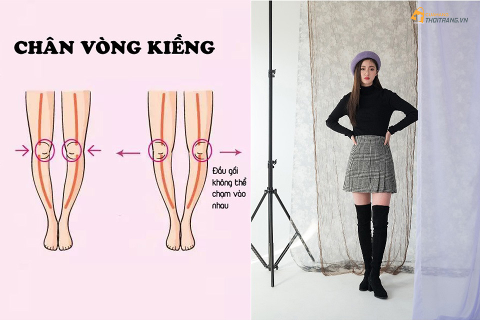 Bạn gái chân vòng kiềng không nên bỏ qua bí kíp chọn đồ sau
